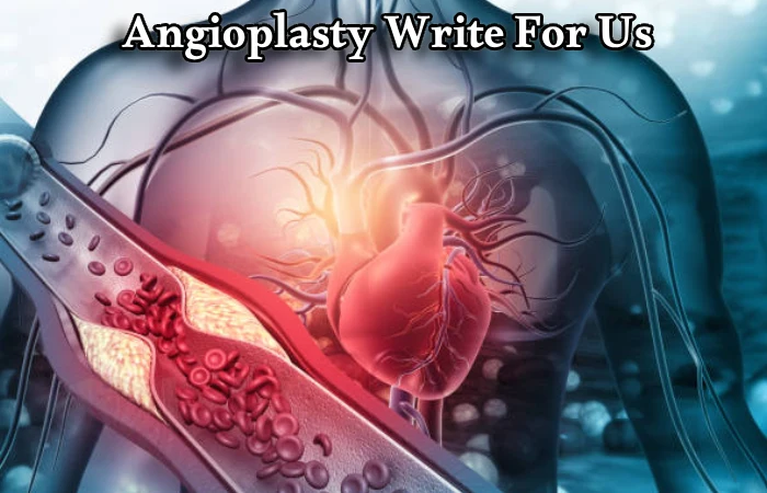 Angioplasty Write For Us