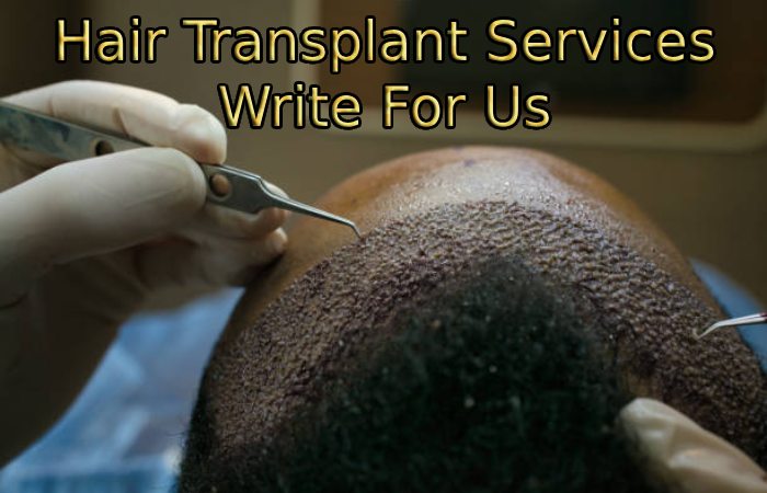 Hair Transplant Services Write For Us